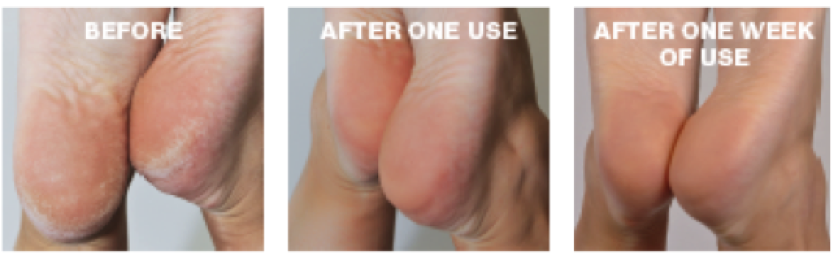 Before and After shots