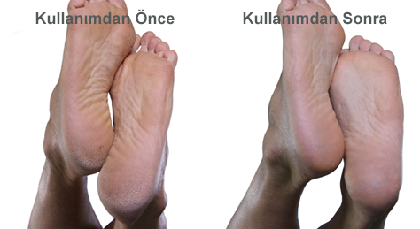 See MICRO pedi MAN before and after shots